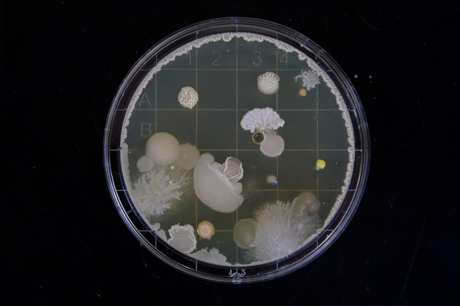 Gut microbiome