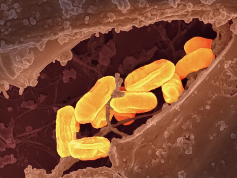 Photo Gut microbiome